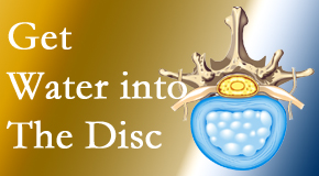 Layden Chiropractic uses spinal manipulation and exercise to boost the diffusion of water into the disc which helps the health of the disc.