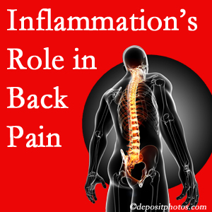 The role of inflammation in Plainville back pain is real. Chiropractic care can help.