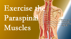 Layden Chiropractic explains the importance of paraspinal muscles and their strength for Plainville back pain relief.
