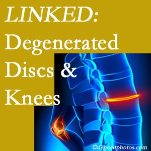 Degenerated discs and degenerated knees are not such strange bedfellows. They are seen to be related. Plainville patients with a loss of disc height due to disc degeneration often also have knee pain related to degeneration.  