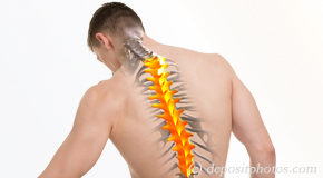 Plainville thoracic spine pain image 