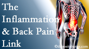 Layden Chiropractic tackles the inflammatory process that accompanies back pain as well as the pain itself.