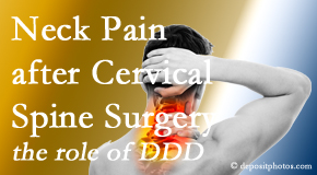 Layden Chiropractic offers gentle treatment for neck pain after neck surgery.