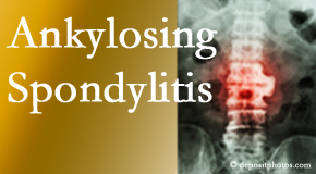 Ankylosing spondylitis is gently cared for by your Plainville chiropractor.