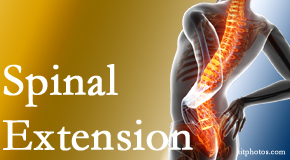 Layden Chiropractic knows the role of extension in spinal motion, its necessity, its benefits and potential harmful effects. 