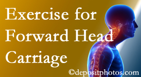 Plainville chiropractic treatment of forward head carriage is two-fold: manipulation and exercise.