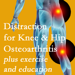 A chiropractic treatment plan for Plainville knee pain and hip pain caused by osteoarthritis: education, exercise, distraction.