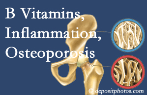 Plainville chiropractic care of osteoporosis usually comes with nutritional tips like b vitamins for inflammation reduction and for prevention.
