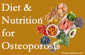Plainville osteoporosis prevention tips from your chiropractor include improved diet and nutrition and reduced sodium, bad fats, and sugar intake. 