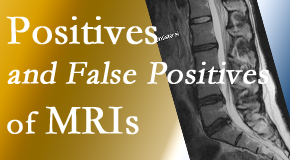 Layden Chiropractic carefully chooses when and if MRI images are needed to guide the Plainville chiropractic treatment plan. 